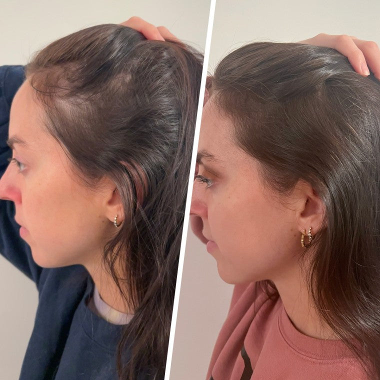 Hair Regrowth Therapy Cap
