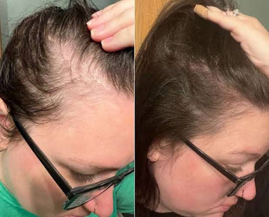 Transform Dull Hair into Vibrant Radiance!