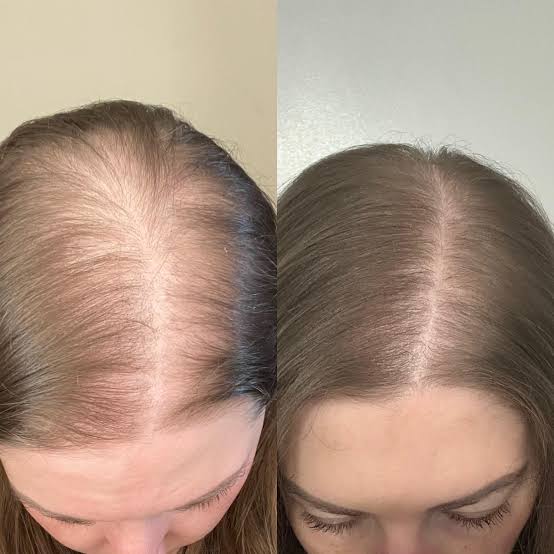 IMG_5719.JPG__PID:2ae86213-a233-4242-8880-d474da6a2b1f