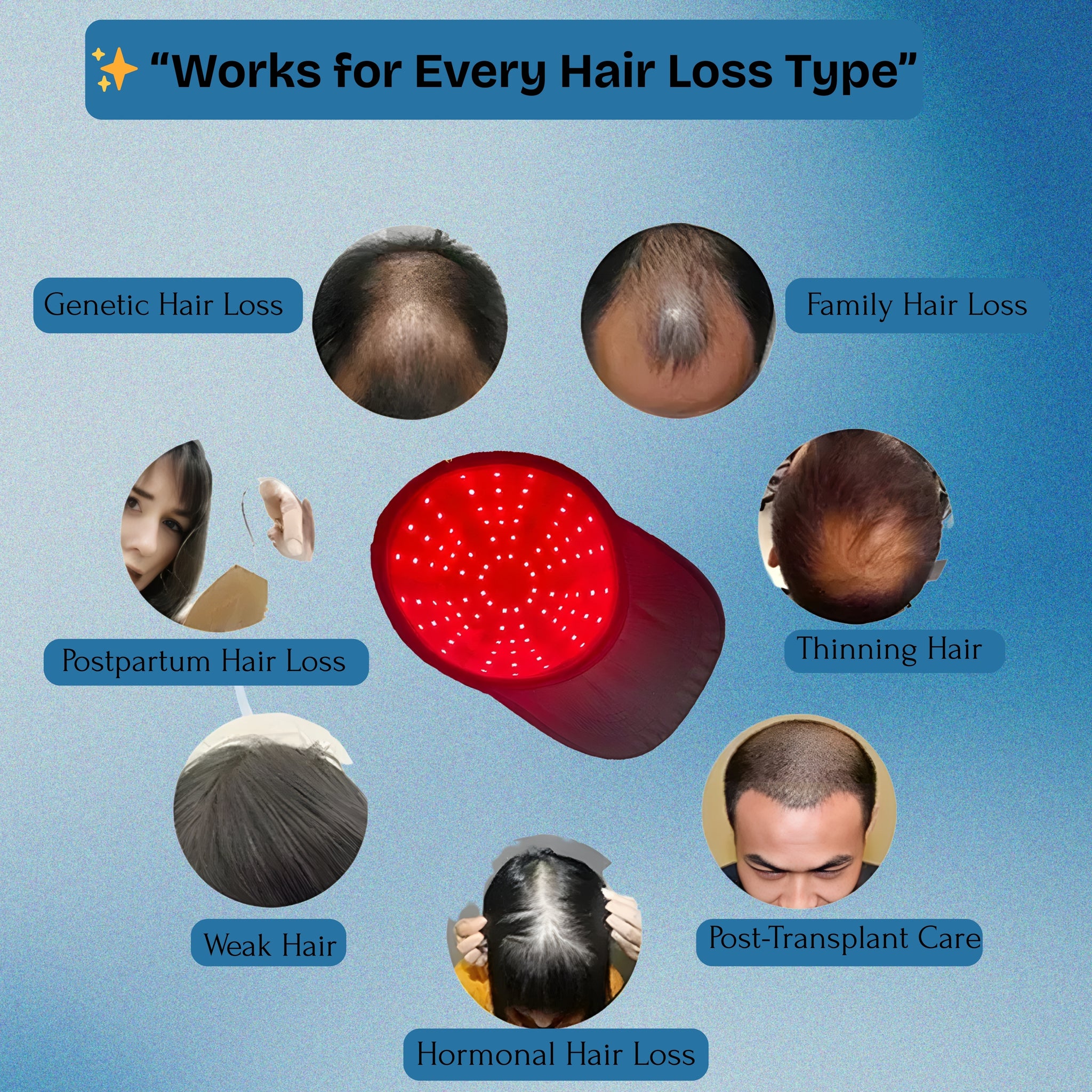 Hair Regrowth Therapy Cap
